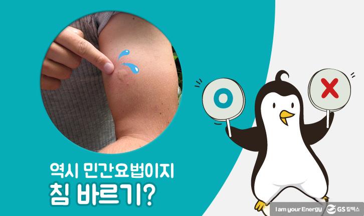 모기에 물렸을 때 올바른 대처법 3 모기에 물렸을 때 올바른 대처법 | mosquito 01 1 1