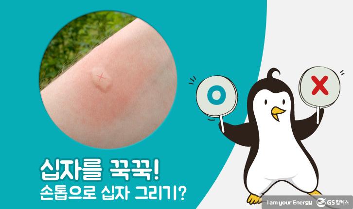 모기에 물렸을 때 올바른 대처법 7 모기에 물렸을 때 올바른 대처법 | mosquito 05 1 1