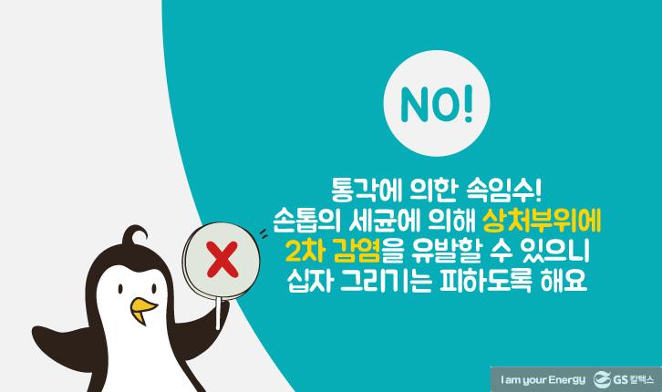 모기에 물렸을 때 올바른 대처법 8 모기에 물렸을 때 올바른 대처법 | mosquito 06 1 1